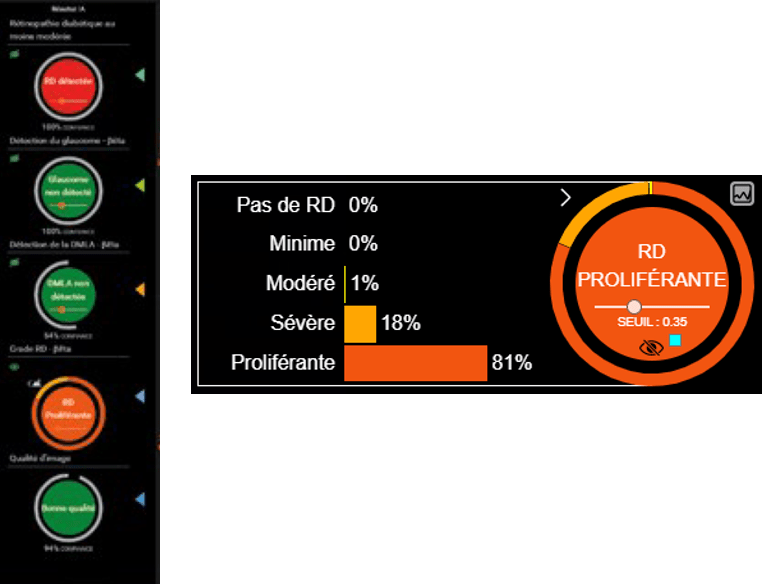 Retina image quality analysis